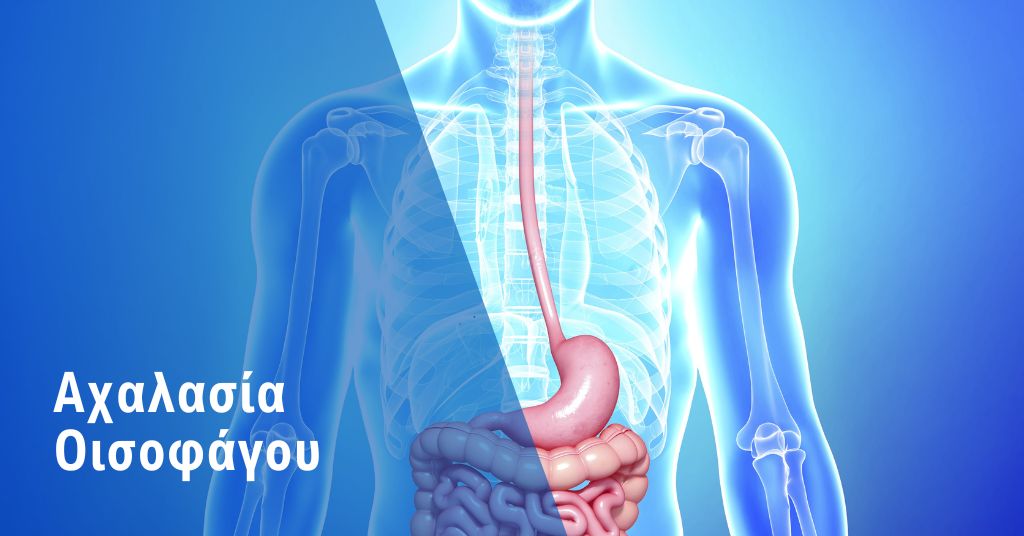 Αχαλασία Οισοφάγου