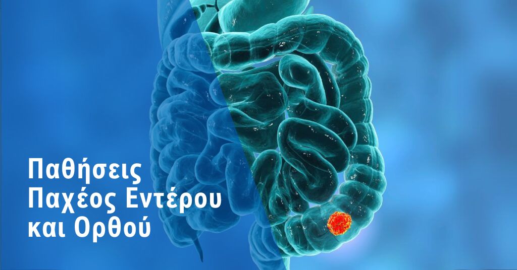 Παθήσεις Παχέος Εντέρου