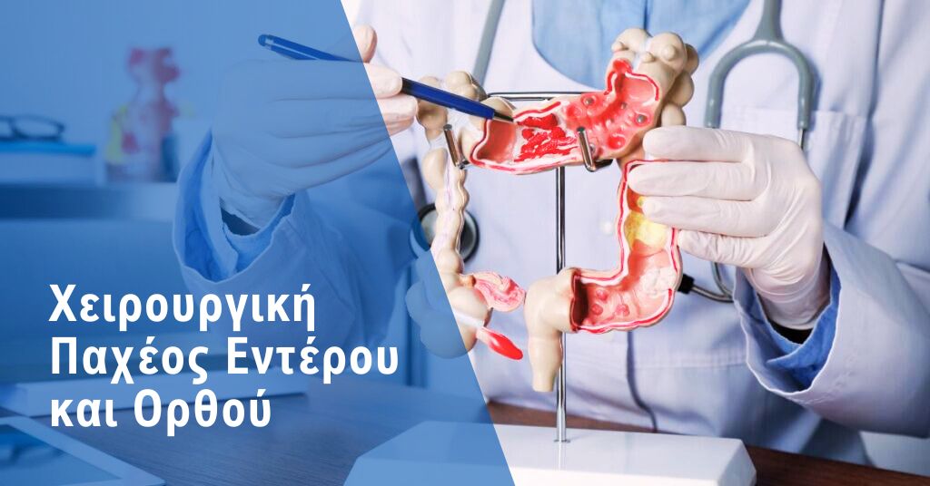 Χειρουργική Παχέος Εντέρου και Ορθού